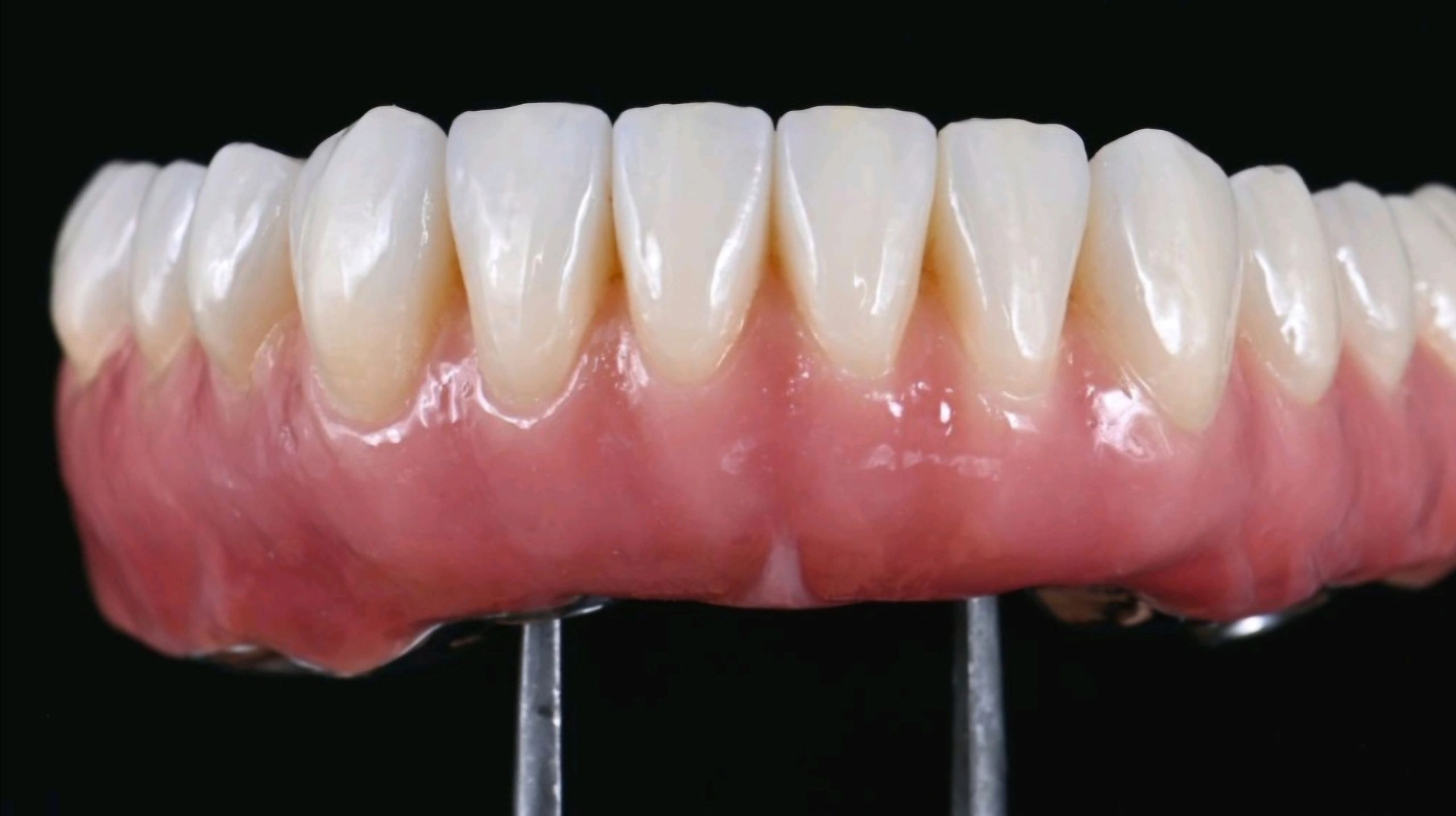 Dental prosthetic restoration work 6