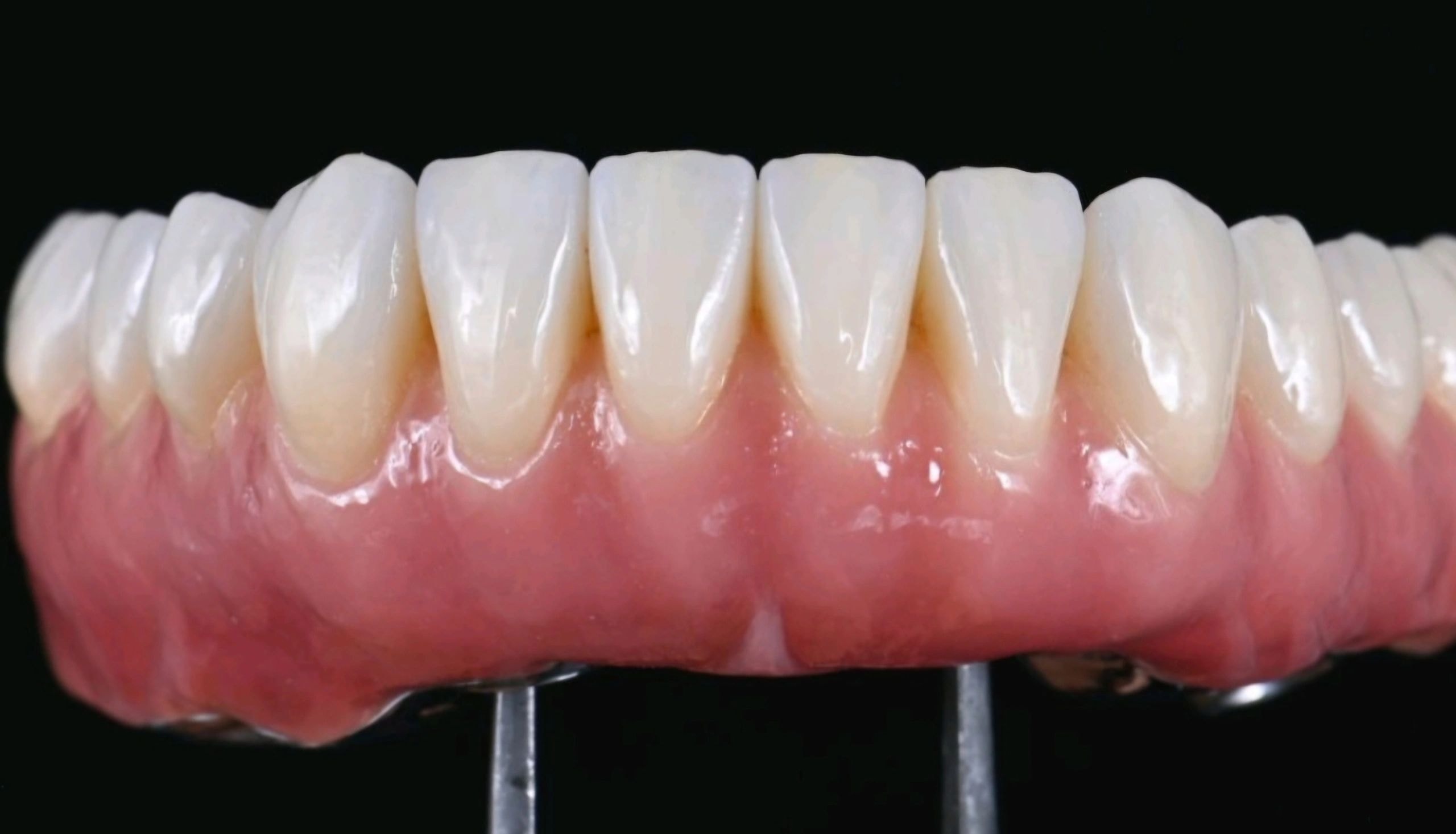 Dental prosthetic restoration work 7