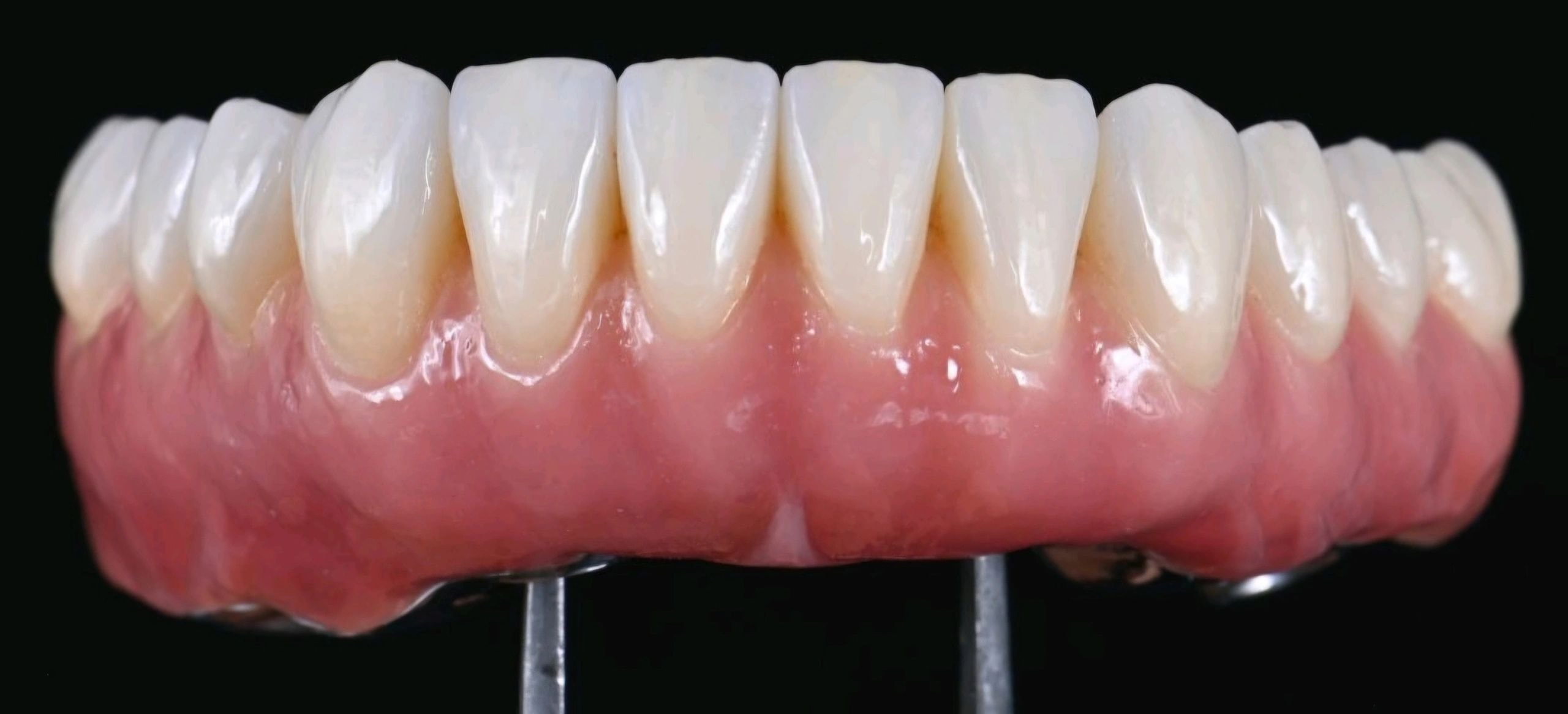 Dental prosthetic restoration work 8