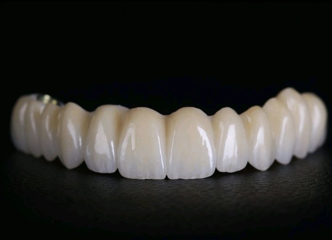 Dental prosthetic restoration work 9
