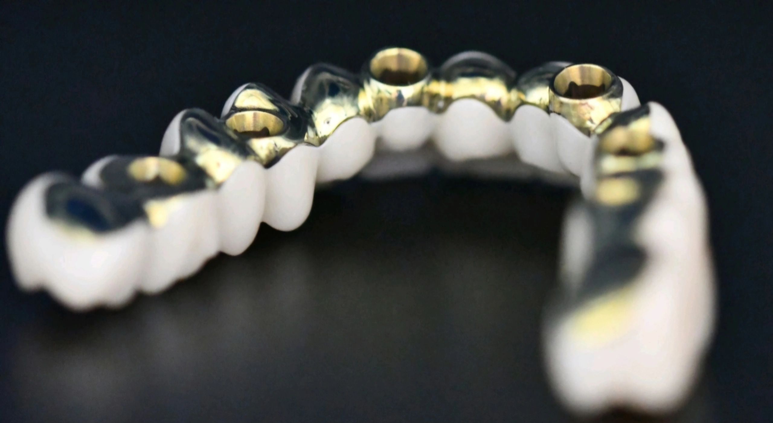 Metal dental crown and bridge prosthetics